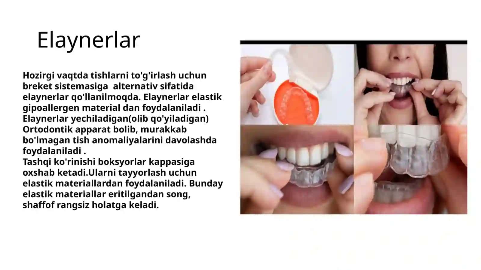Elaynerlar 3