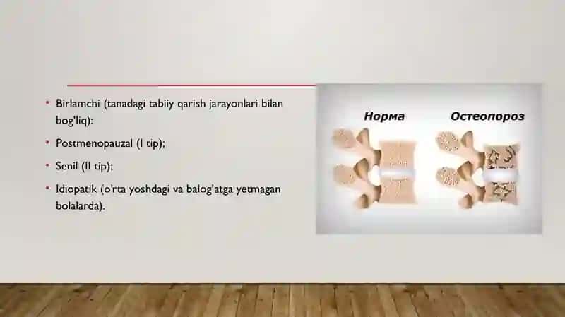 Osteoporoz kasalliklari 3