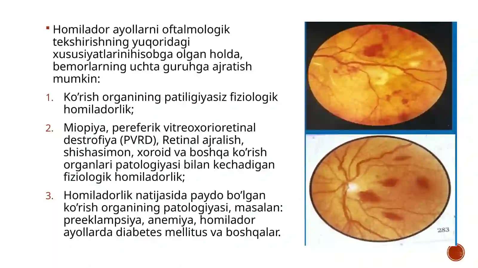 Homilador ayollarda oftalmik holatning klinik xususiyatlari 3