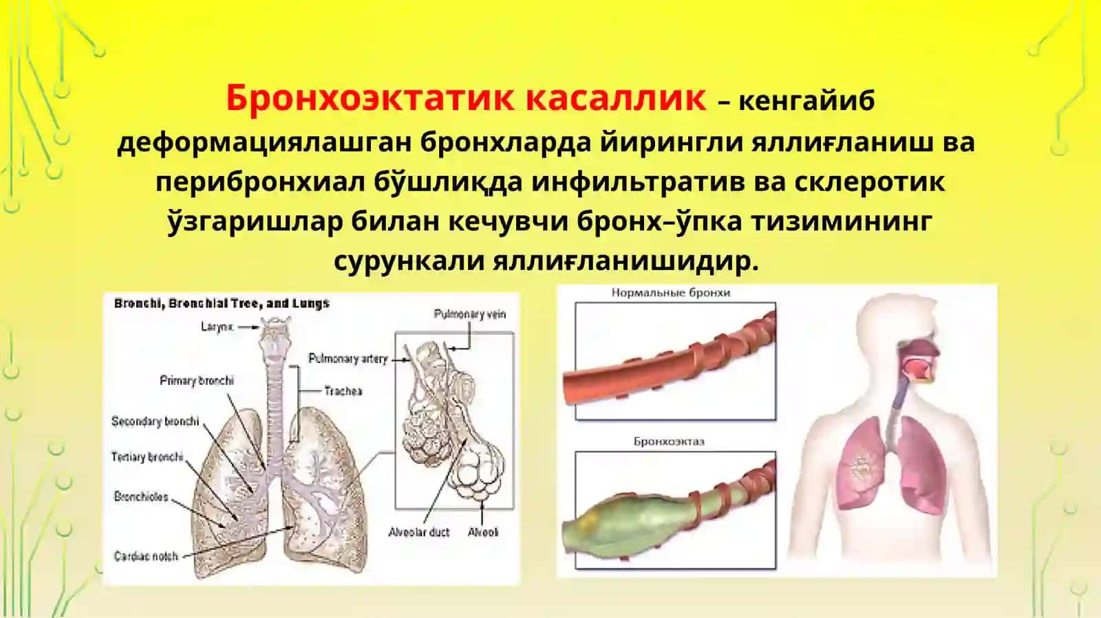 Бронхоэктатик касаллик 3
