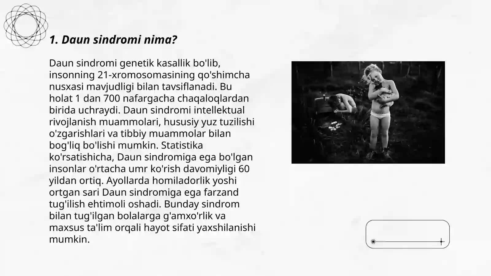 Daun sindromiga chalingan bolalar 3