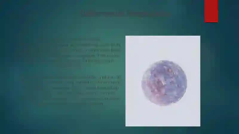 Dermatomiozit 3