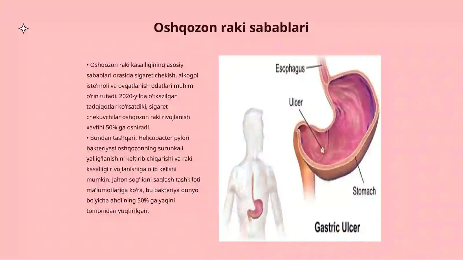Oshqozon raki kasalligi 3