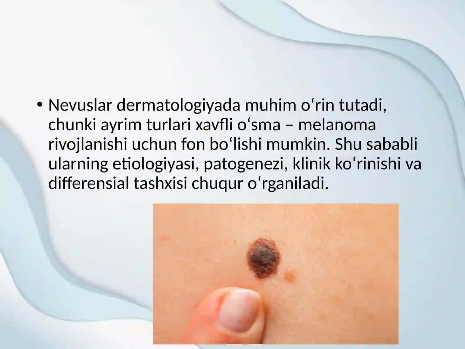 Nevuslar 3
