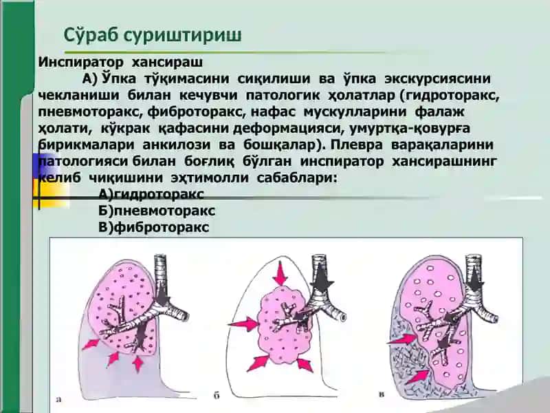 Хансираш (dyspnea) 3