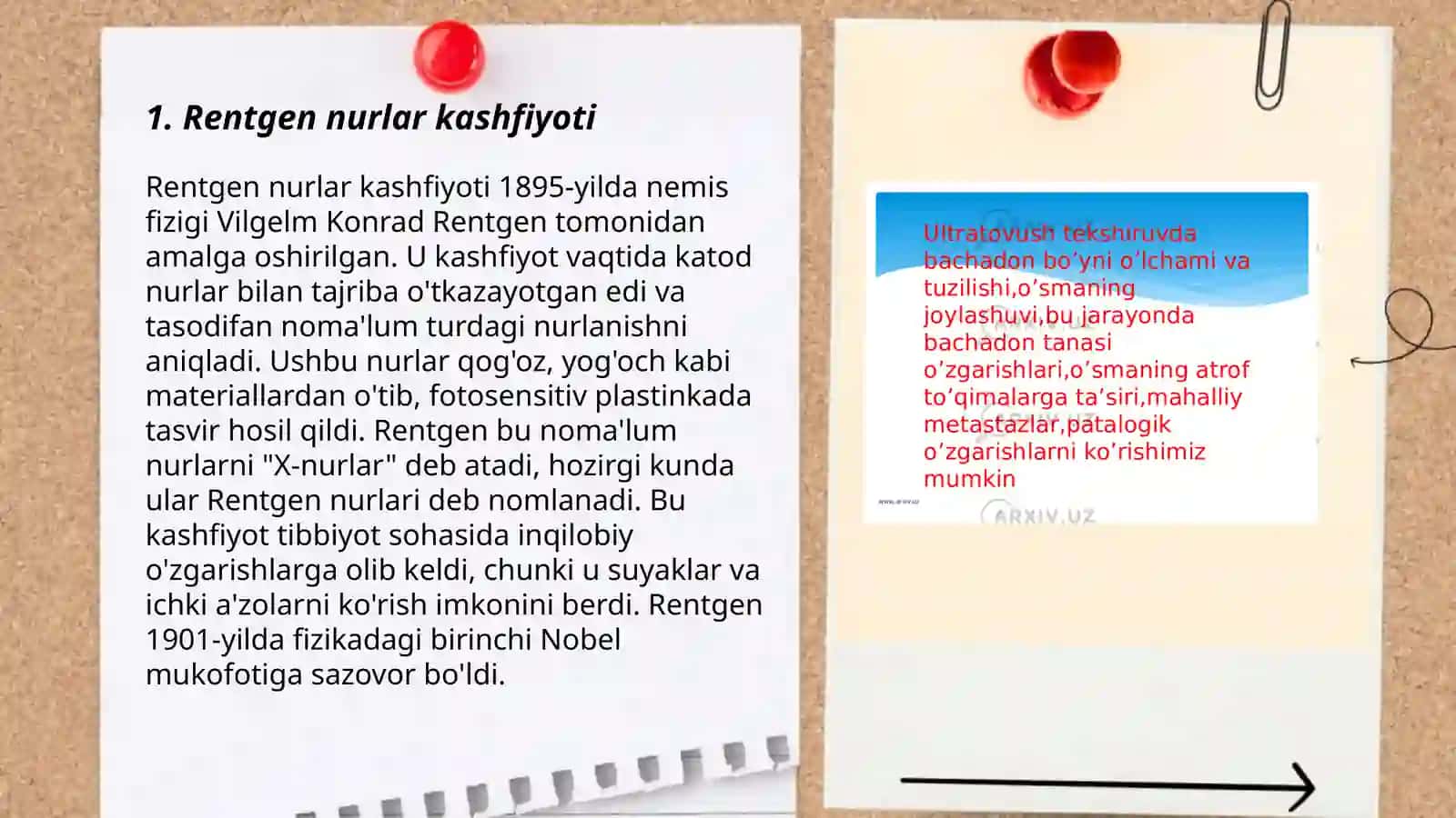 Rentgen nurlarni ōrganish tarixi, suyak va boğimlar rivojlanishini rentgen nurlar yordamida ōrganish 3