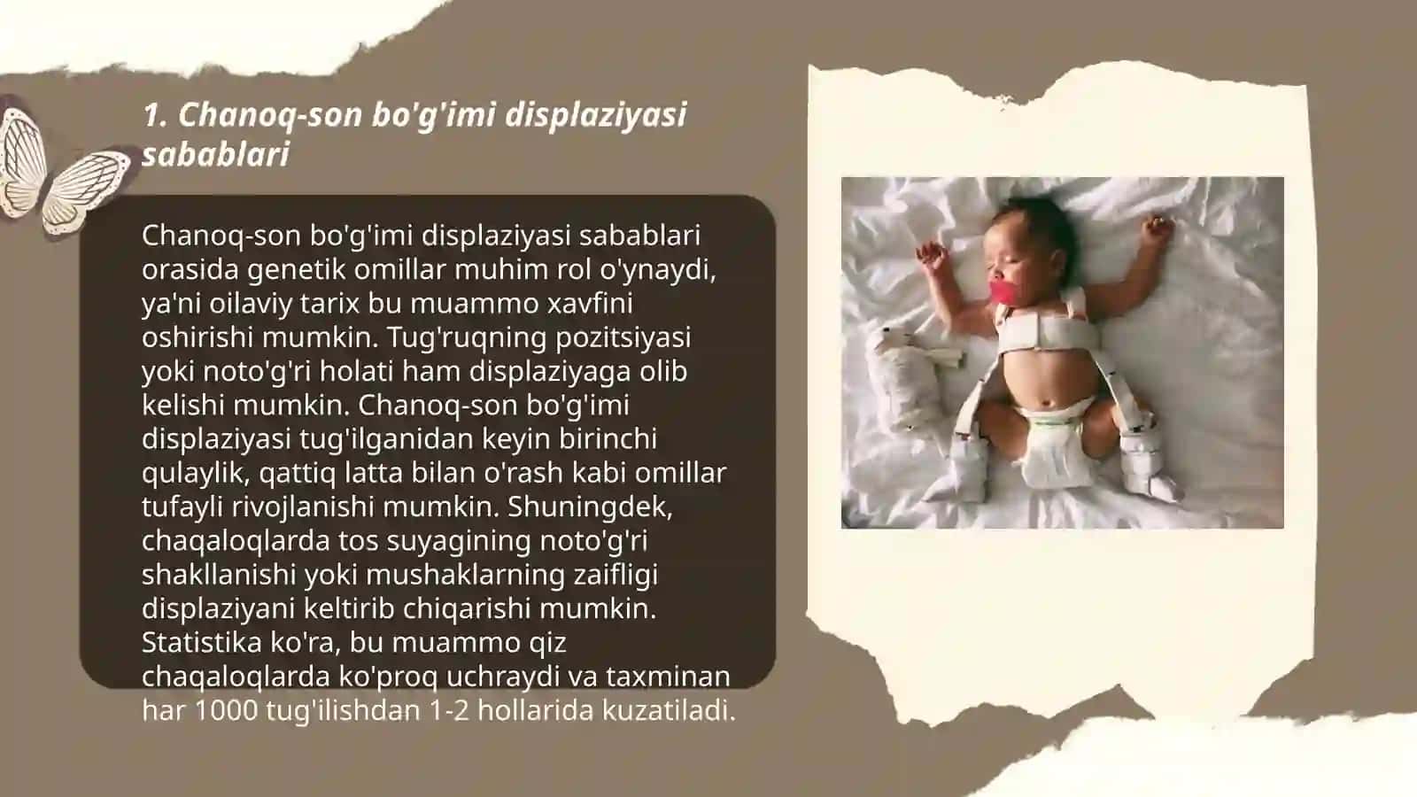 Bolalarda chanoq - son bo'g'imi displaziyasi 3