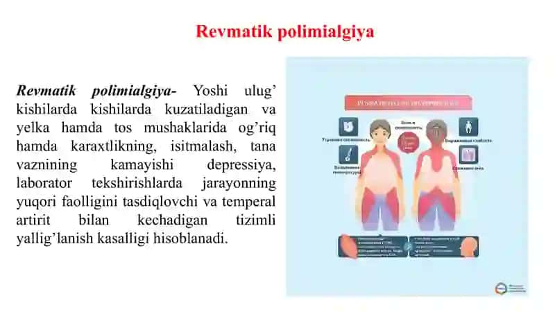 Revmatik polimialgiya 3