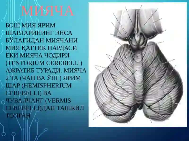 Мияча 3