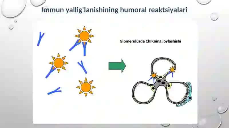 O’TKIR GLOMERULONEFRIT 3
