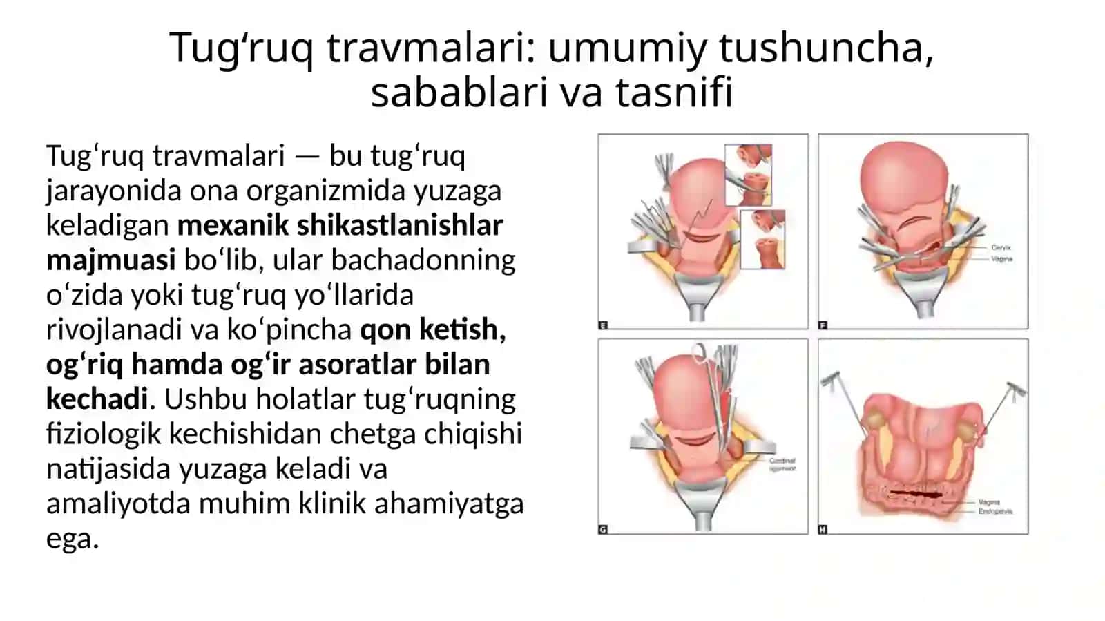 Tug‘ruqdaonalartravmasi:bachadonag‘darilishi(inversiouteri),bachadonyorilishi(rupturauteri),bachadonbo‘shlig‘iniqo‘lbilantekshirish,bachadonbo‘yni,qinvaoraliqyirtilishlarihamdatug‘ruqvatug‘ruqdankeyingidavrdaqonketishvaunito‘xtatishusullari 3