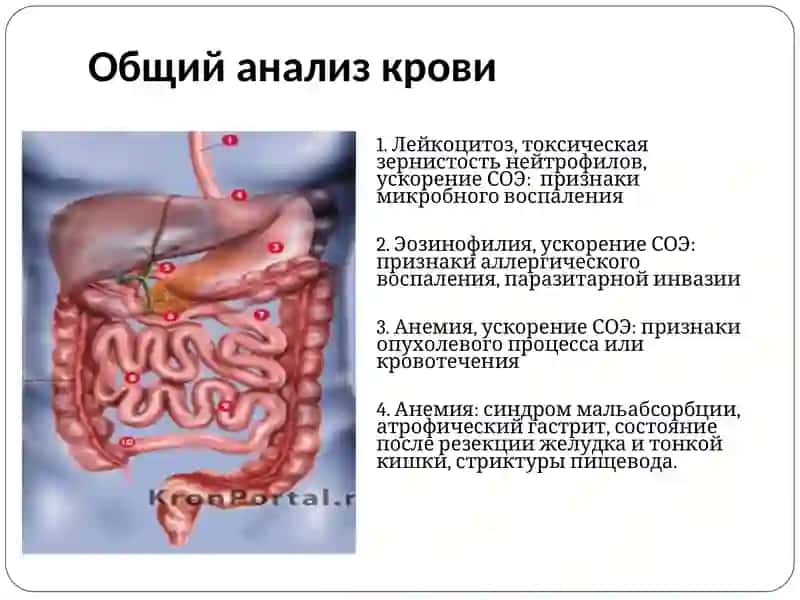 Желудочно-кишечный тракт методы диагностики 3