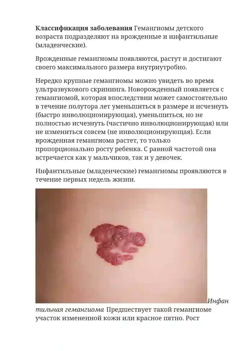 Гемангиома 3