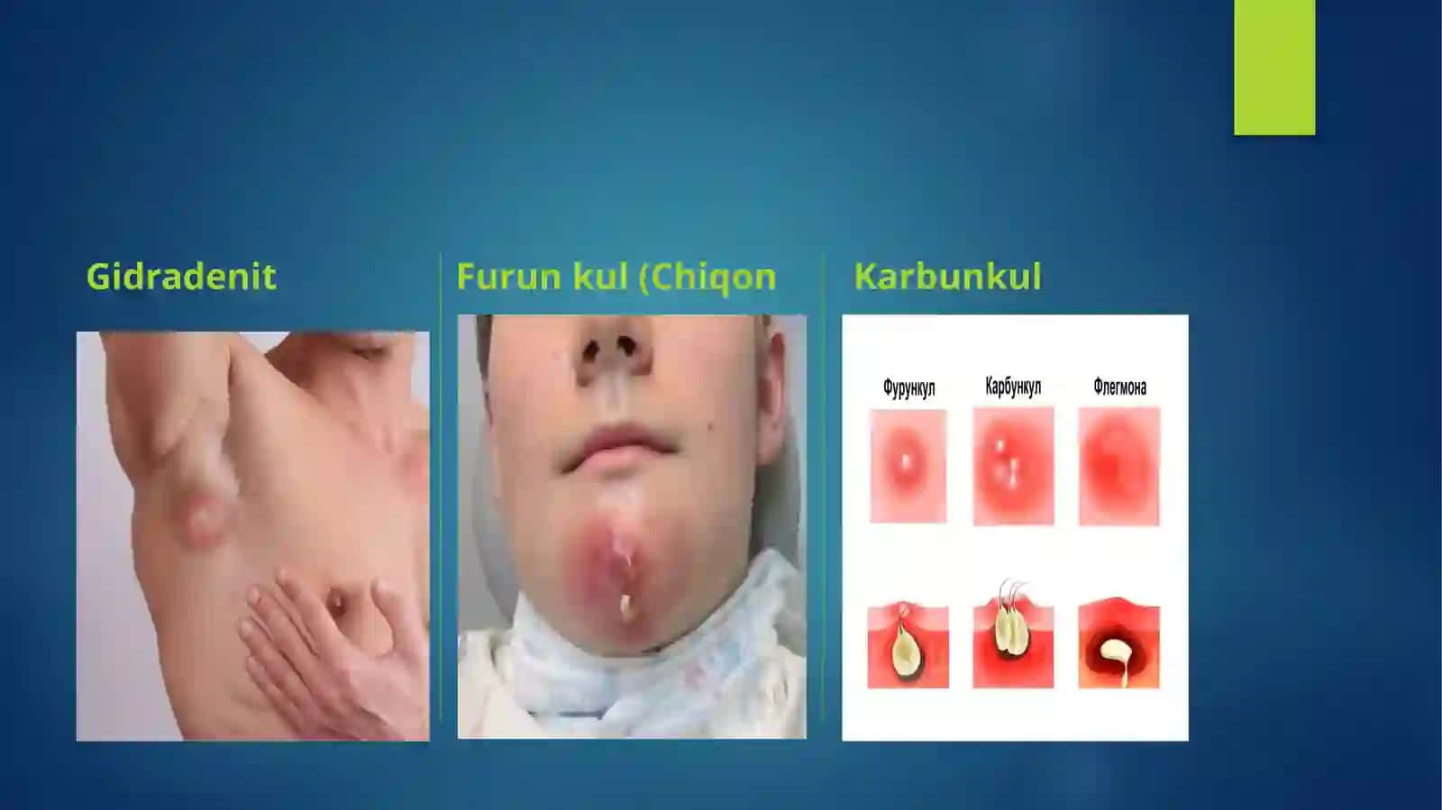 YIRINGLI XIRURGIK KASALLIKLAR VA PARVARISHLASHNING UMUMIY HUSUSIYATI 3