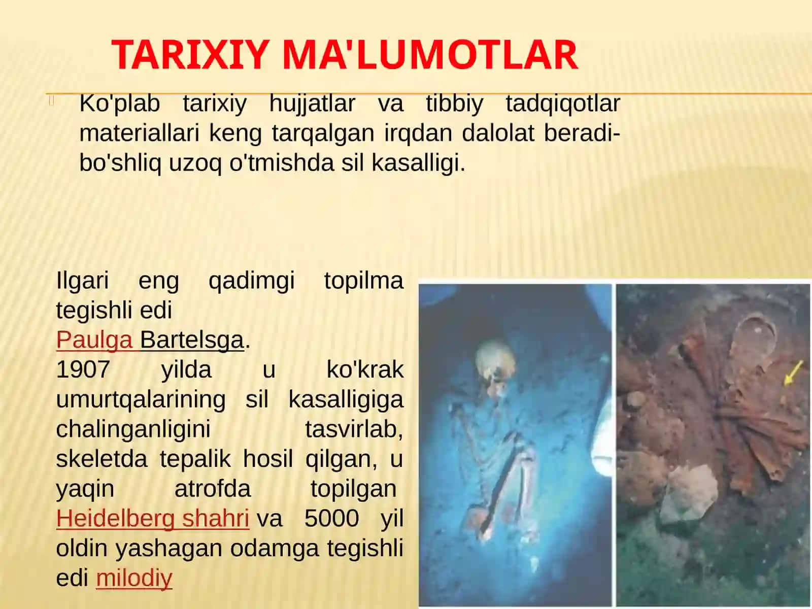 O'pka tuberkulyozi 3