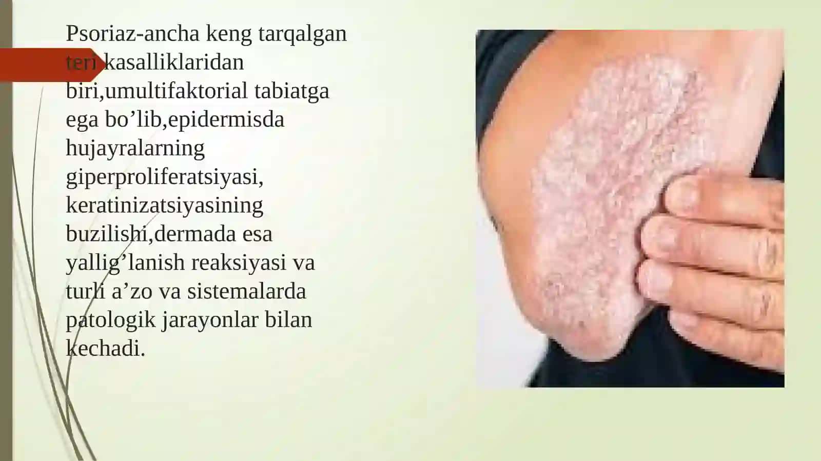 Etiologiyasi yetarli aniqlanmagan teri kasalliklarida hamshiralik parvarishi 3