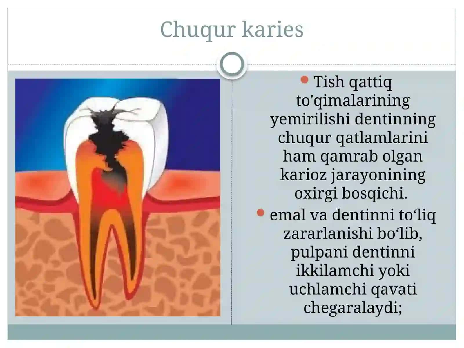 [Chuqur karies] 3