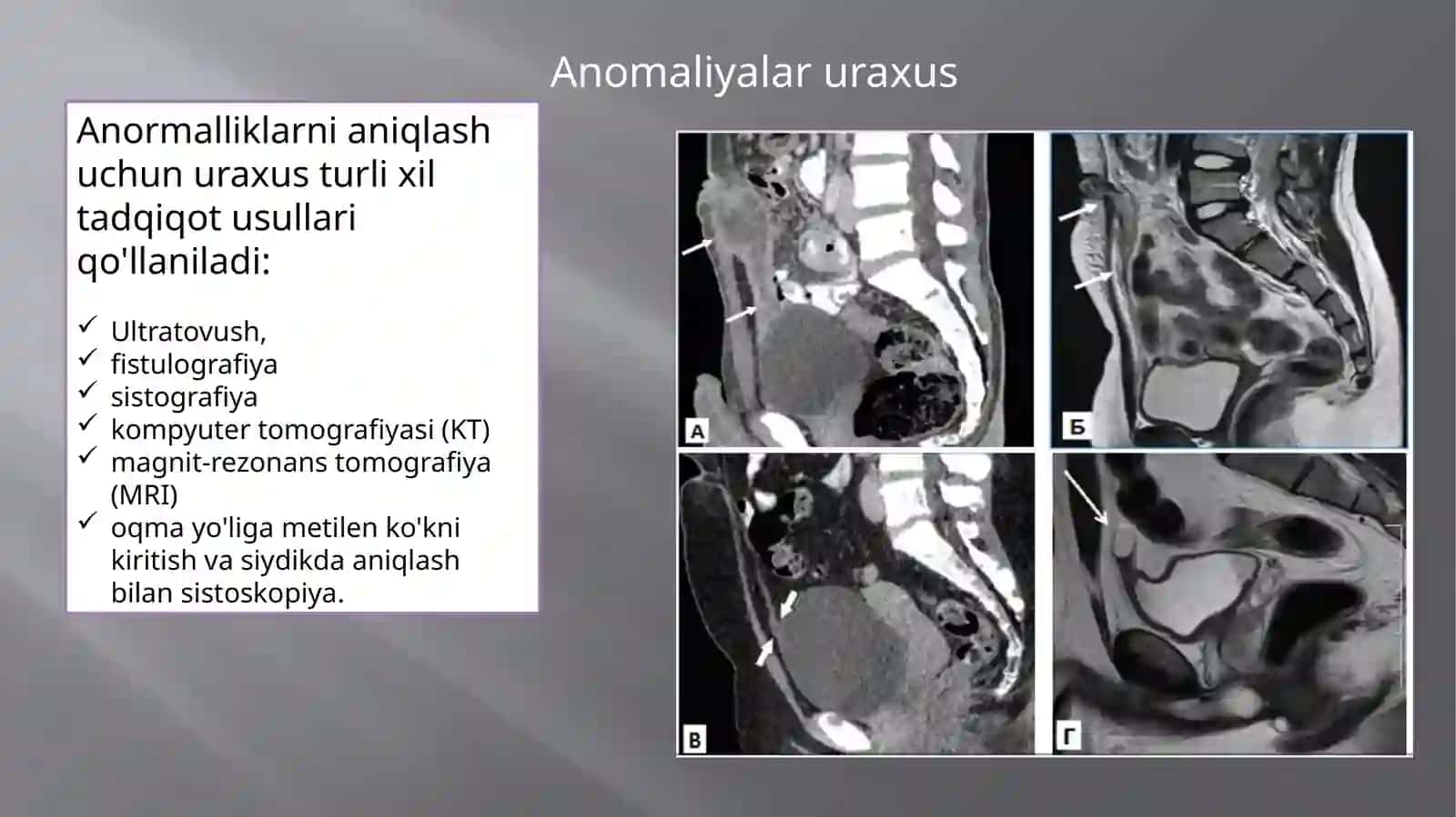 Anomaliyalar uraxus 3