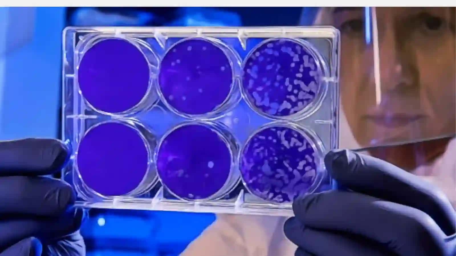 Bakteriyalarni antibiotiklarga chidamli shakllarini paydo bo’lish mexanizmlari 3