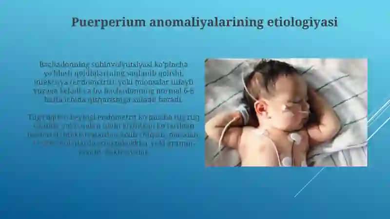 Puerperal davr anomaliyalari etialogiyasi klinikasi va diagnostikasi 3