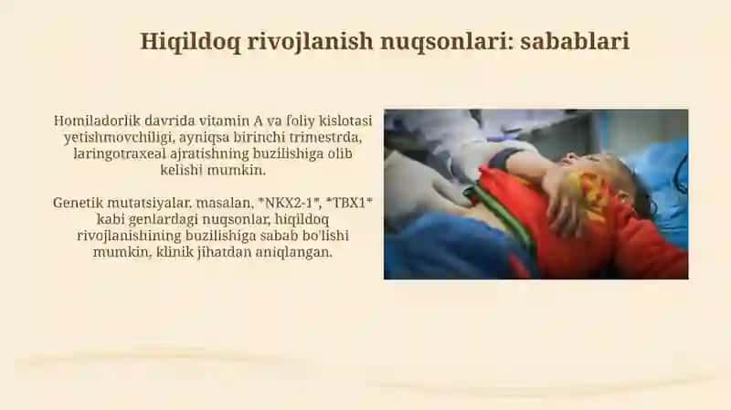 Hiqildoq rivojlanish nuqsonlari: sabablari 3