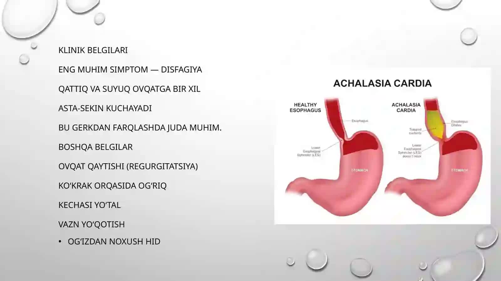 Kardiya axalaziyasi.Gastroezofageal refluks kasalligi.Barret qizilo’ngachi. Oshqozon va o’n ikki barmoqli ichak yara kasalligi asoratlari, diagnostikasi 3