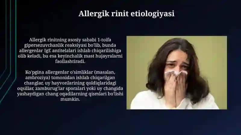 Allergik Rinit 3