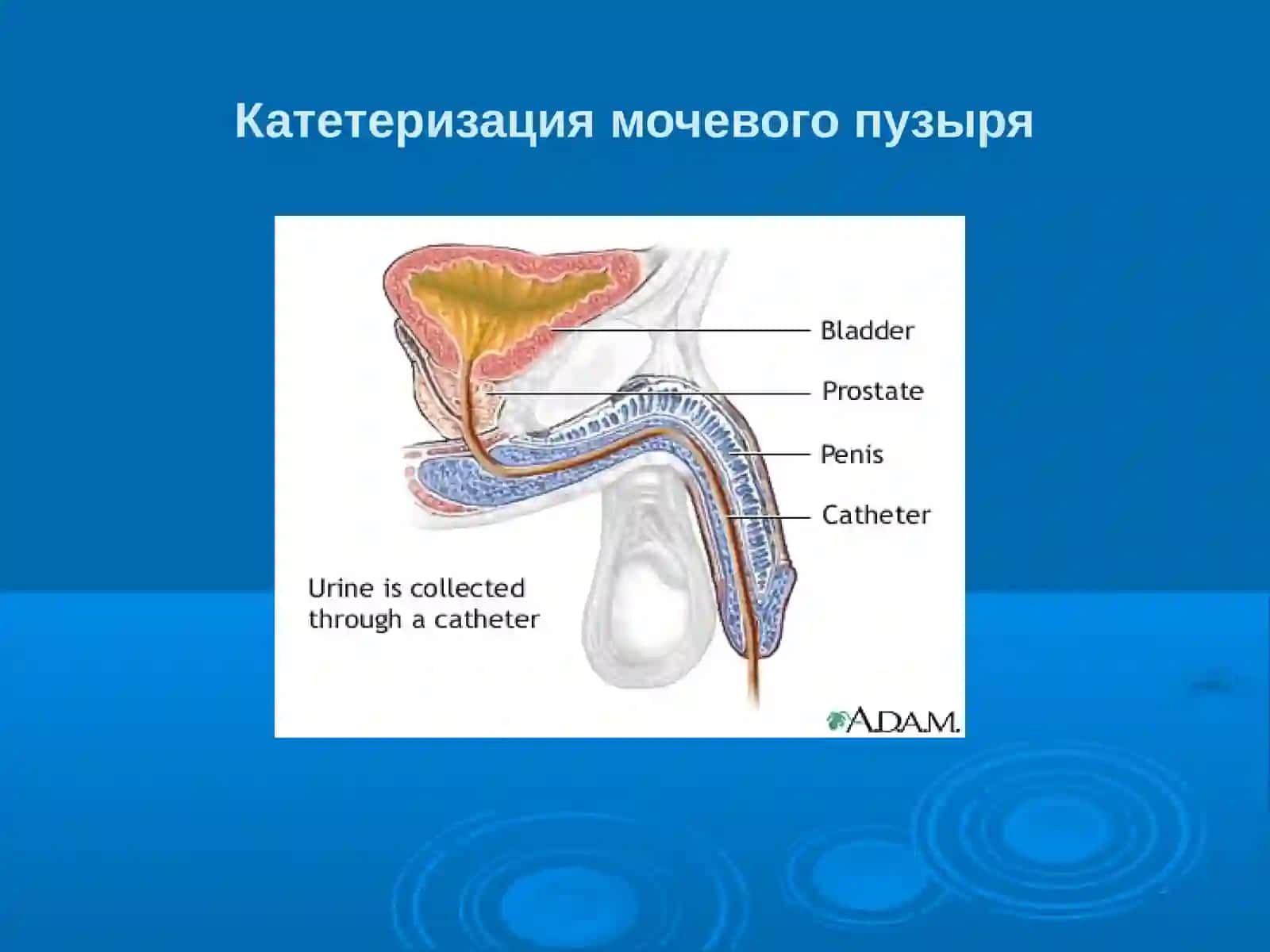 Эндоскопическая урология. Инструментальная урология 3