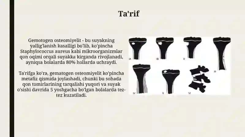 Gematogenli osteomielit 3