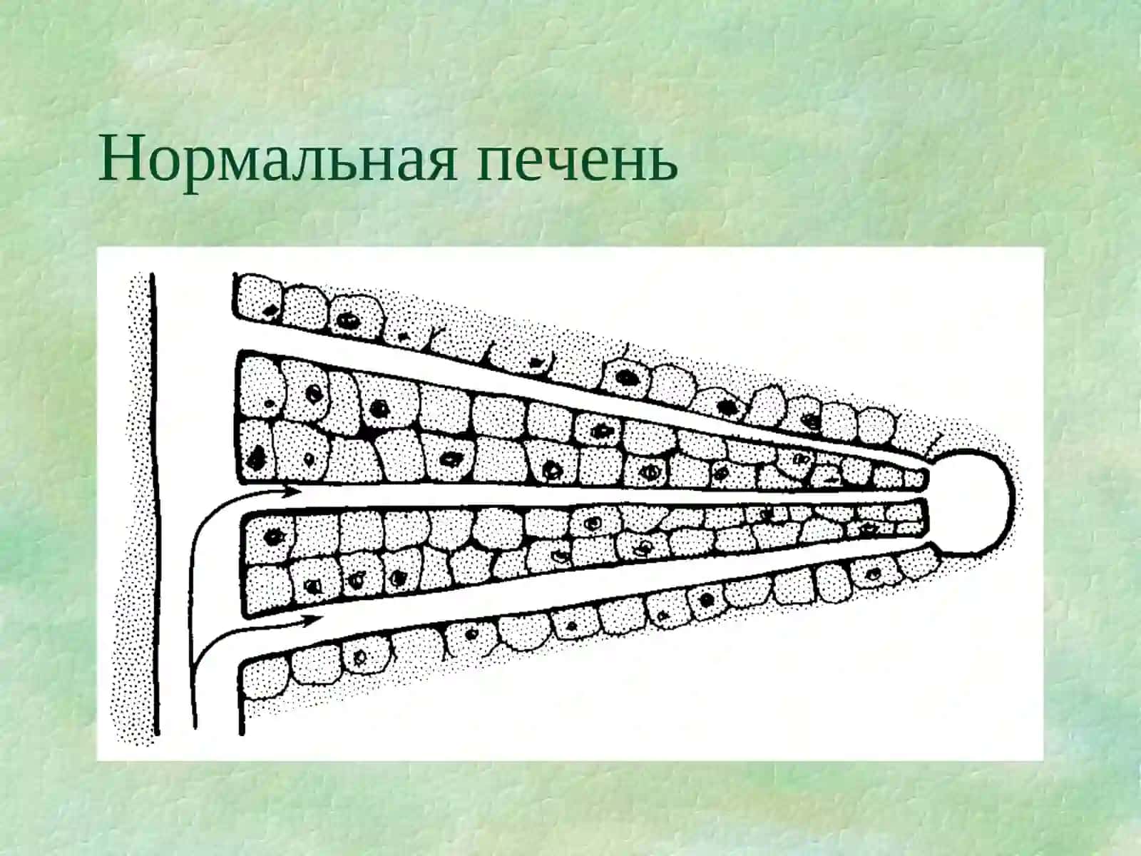 Вирусные гепатиты 3