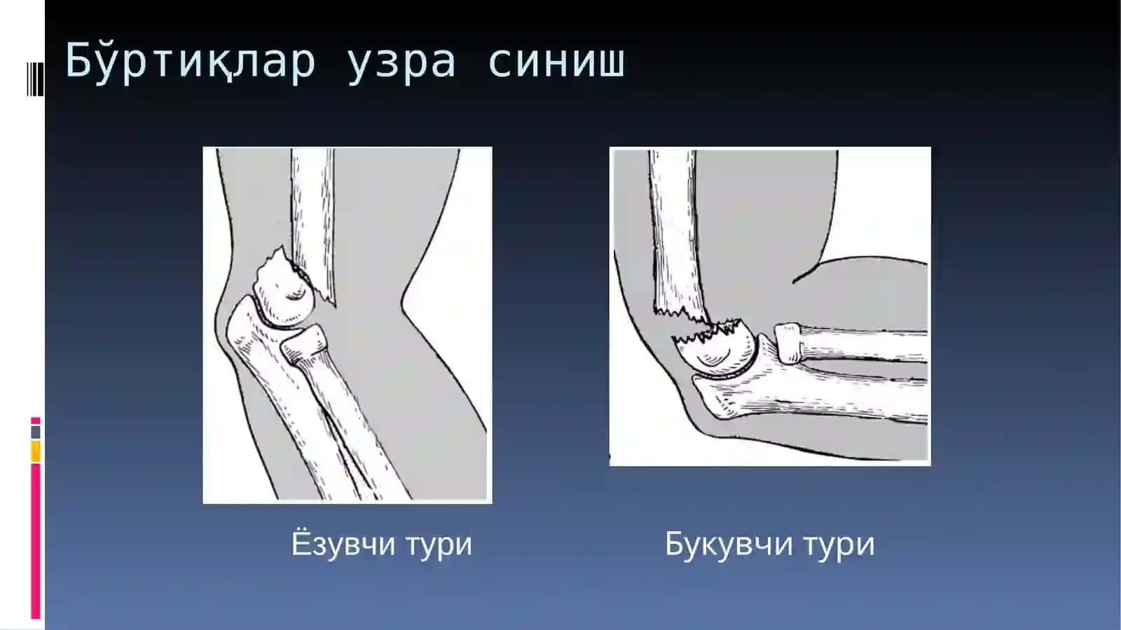 ТИРСАК БЎҒИМИ СОХАСИ ЖАРОХАТЛАРИ 3