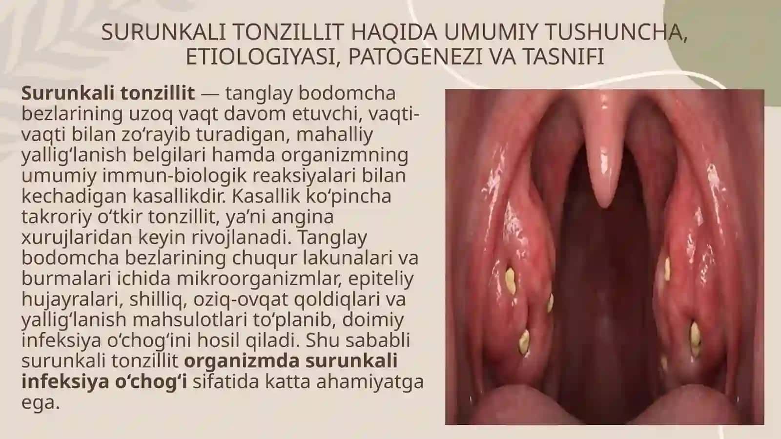 Surunkali tonzillit ; tasnifi, tashxisi, davolashi 3