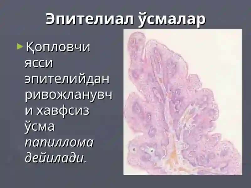 Эпителиал ва мезенхималўсмалар 3