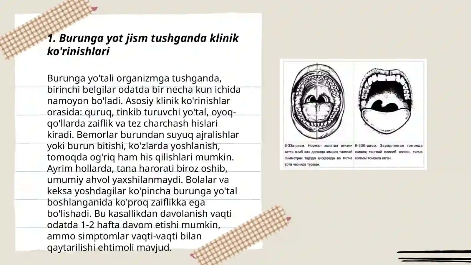Burunga yot jism tushganda klinikasi, etiologiyasi, Differensial tashxis, va davolash 3