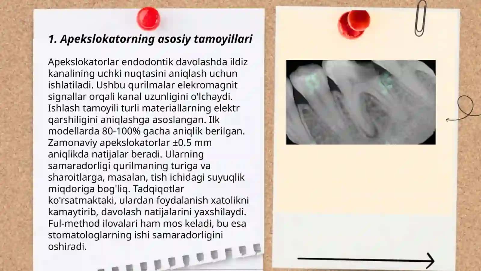 Apekslokatorning asosiy tamoyillari 3