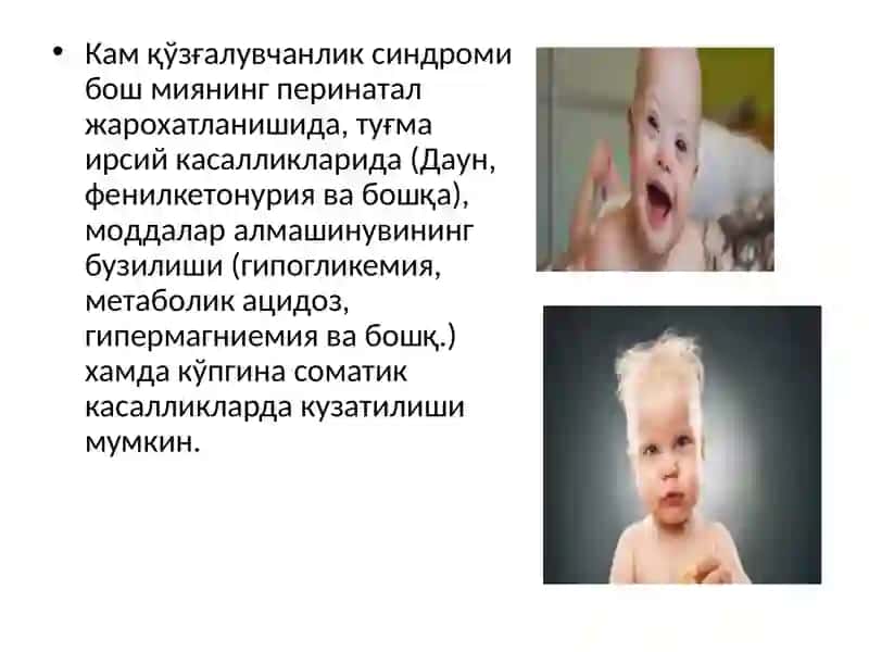 Кам қўзғалувчанлик синдроми 3