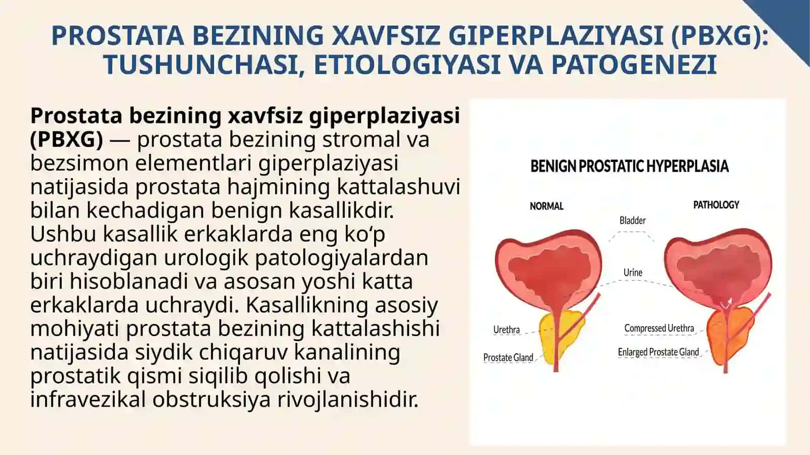 Prostatabezining xavfsiz giperplaziyasi (PBXG) 3