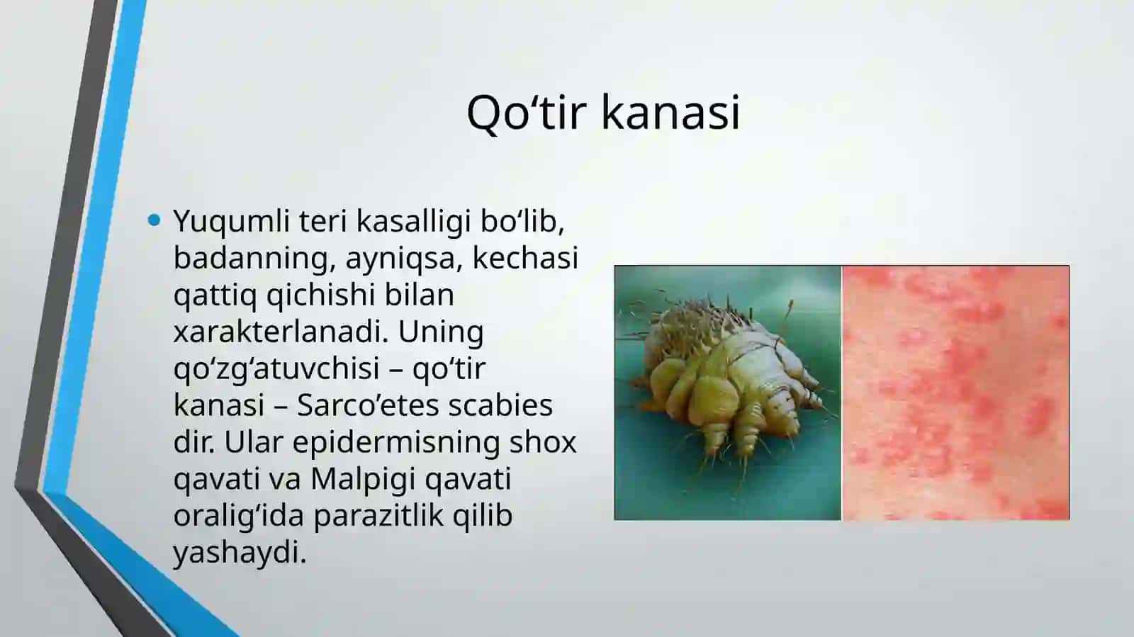 Terining parazitar kasalliklari qiyosiy tashxishi. Zamonaviy diagnostika va davolash yangiliklari 3