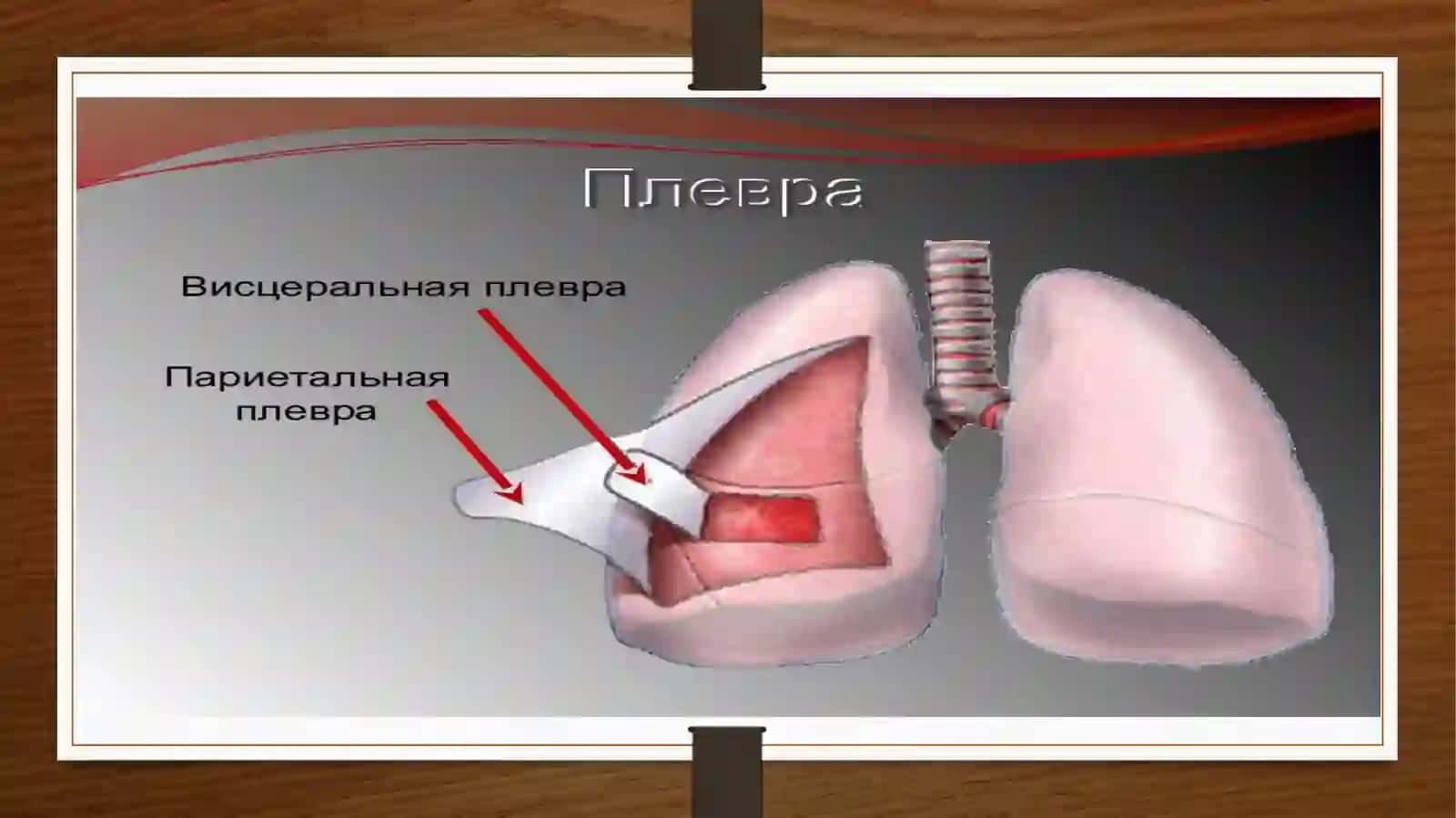 Plevritlaretiologiya 3