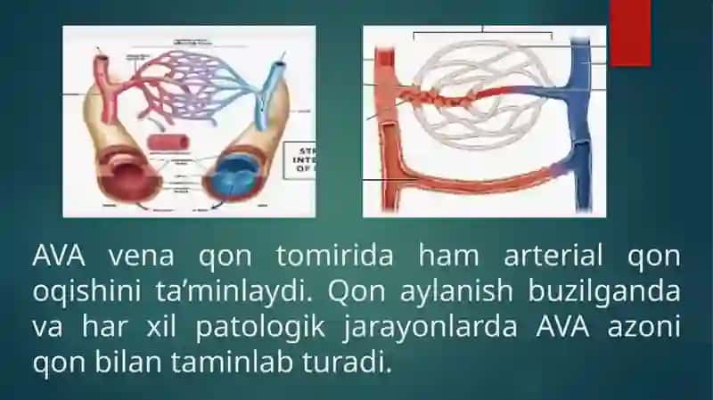 Arteriya-vanulyaranastomoz 3
