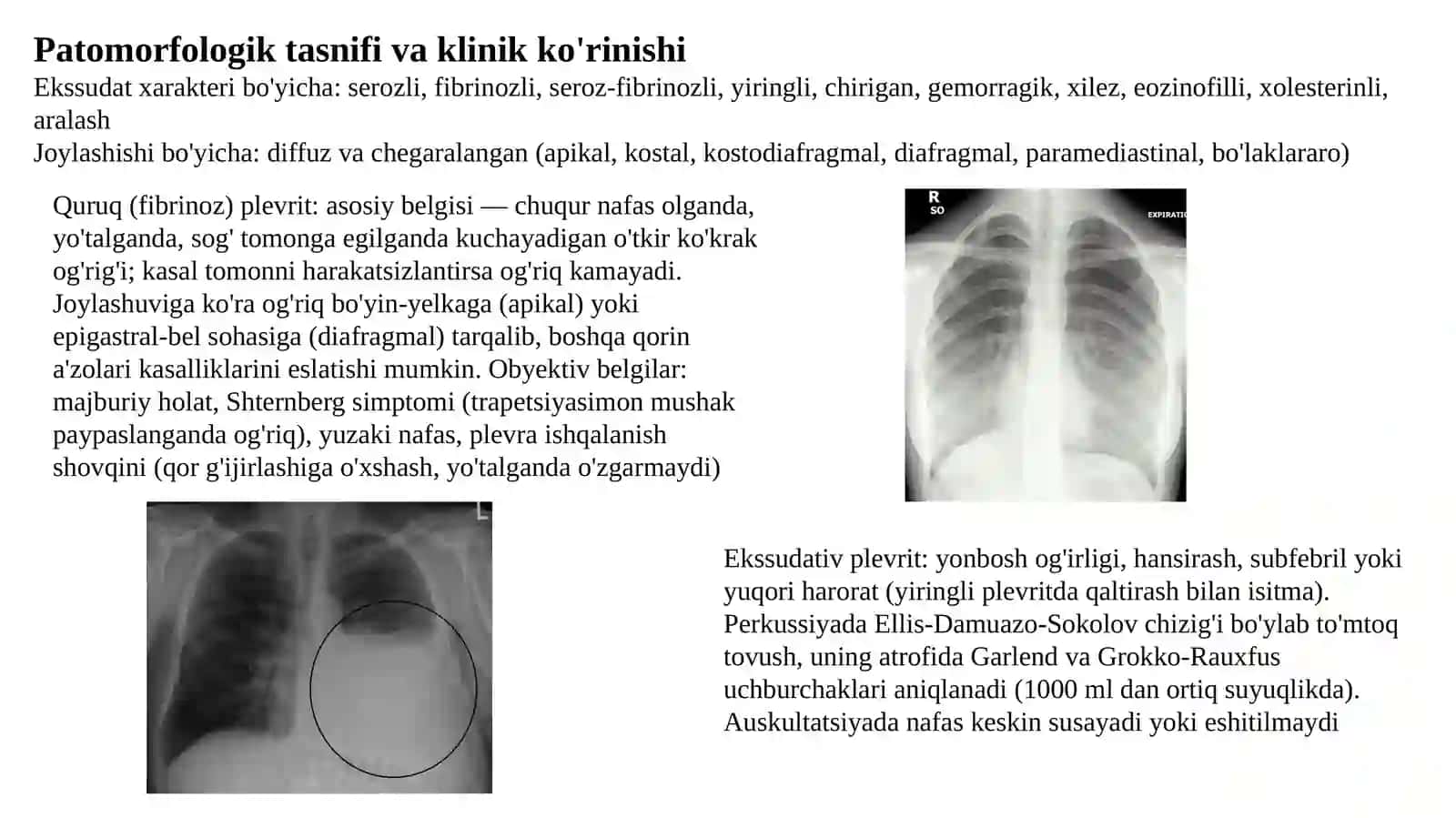 Plevritlar etiologiya, patogenez, patomorfologiya, xarakterli simptomlari. Unda og'iz bo'shlig'ida o'ziga xos o'zgarishlar parhez va medikamentoz davolash. O'pka emfizemasi: etiologiya, patogenez, patomorfologiya, xarakterli simptomlar, og'iz bo'shlig'ida oʻziga xos o'zgarishlar, parhez va medikamentoz davolash. 3