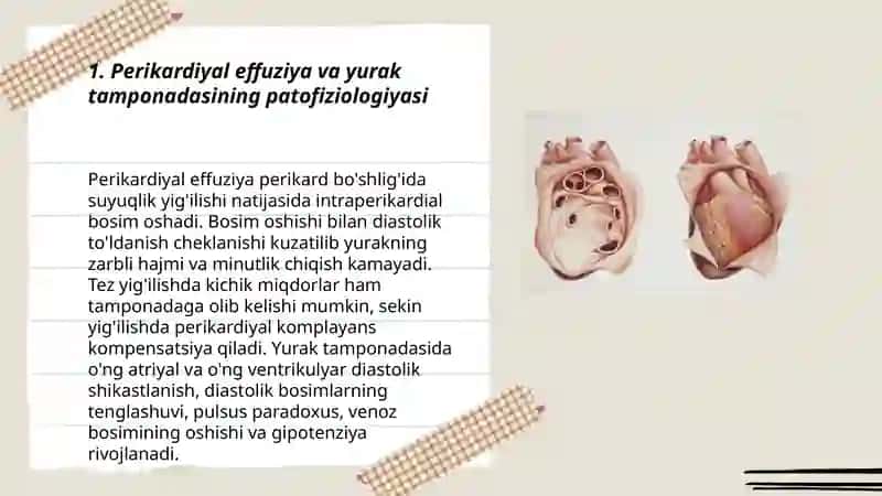Perikard patalogyasida yurak funksiyasini buzilishi 3