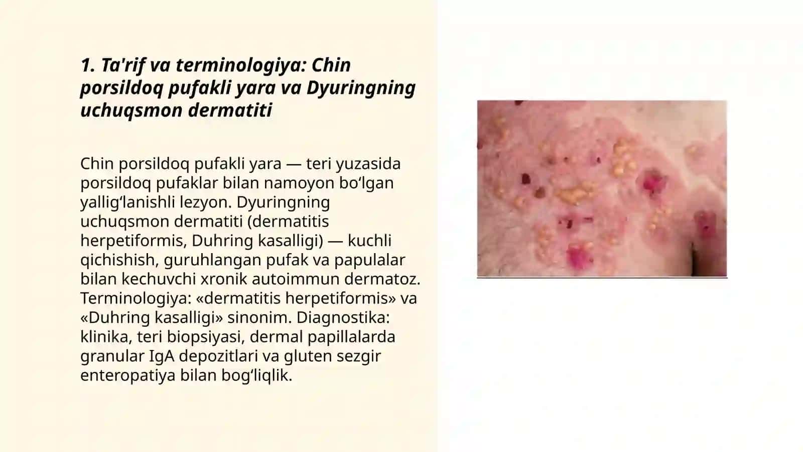 Chin pòrsildoq pufakli yara va Dyuringning uchuqsmon dermatiti 3