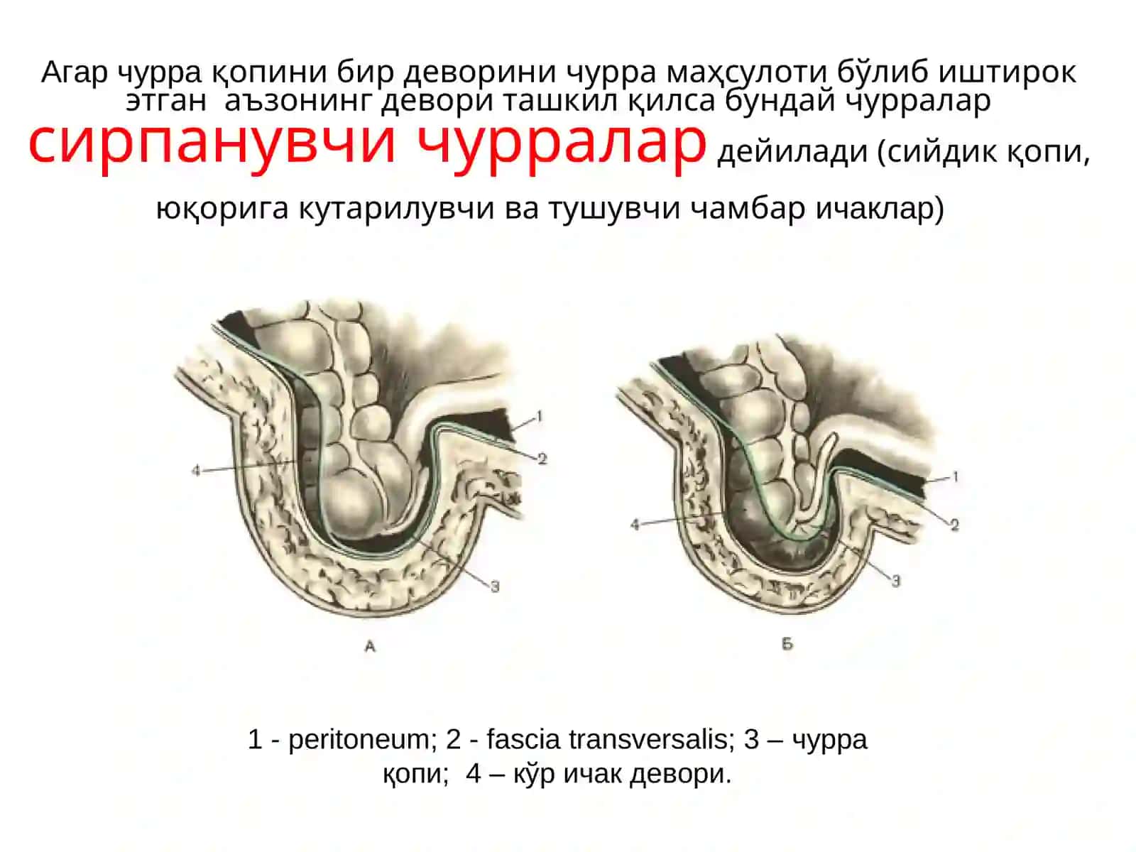 Қорин чурралари 3
