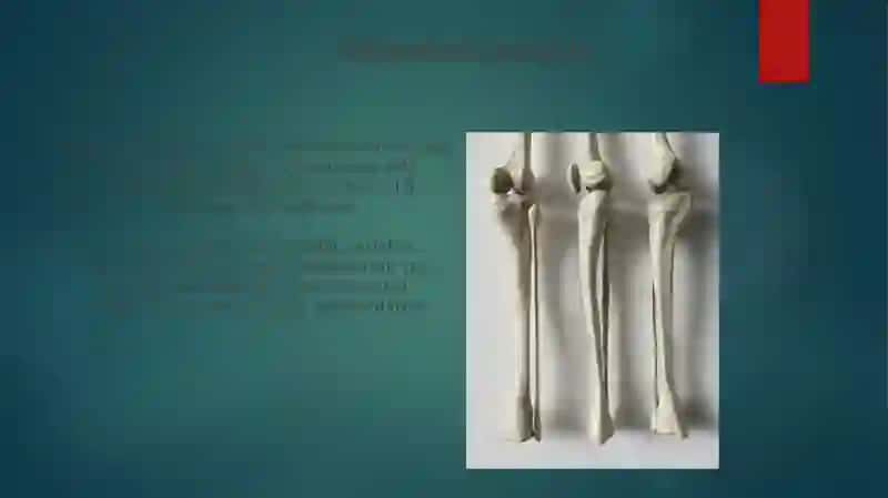 Rotatsion sınıqlar 3