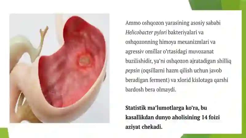 Oshqozon yarasining sababi va muxiti 3