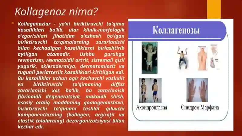 Kollagenozlar 3