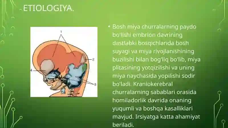 TUG'MA NUQSONLAR. BOLALARDAMIYACHURRASI VA YURAK NUQSONLARI 3