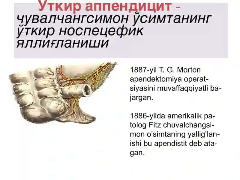 3 yoshgacha bo’lgan bolalarda O`tkir appenditsit 3