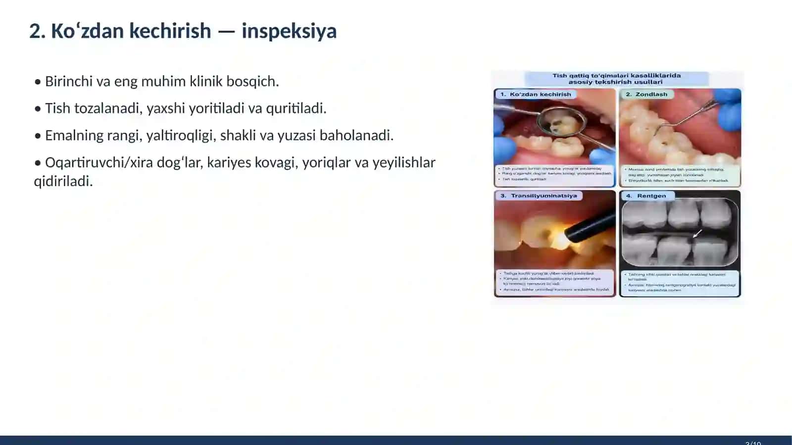 Tish qattiq toqimasi kassaliklarida asosiy tekshirish usullari 3